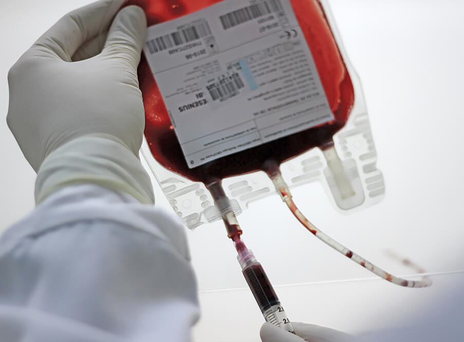 Imagem mostra bolsa de sangue de um banco de sangue de cordão umbilical